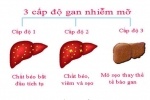 CÁC CẤP ĐỘ GAN NHIỄM MỠ LÀ GÌ?