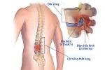 Thoát vị đĩa đệm là gì? Ai dễ mắc thoát vị đĩa đệm?