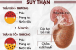 Chớ bỏ qua các triệu chứng suy thận giai đoạn đầu để tránh biến chứng nguy hiểm