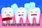 Đừng bỏ lỡ cách trị nhức răng tức thời an toàn hiệu quả. Xem ngay!