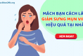 Mách bạn 4 cách giảm sưng mụn viêm cho hiệu quả cực nhanh. XEM NGAY!