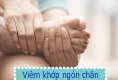 Bệnh viêm khớp ngón chân và những thông tin cần biết