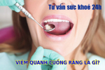 Viêm quanh cuống răng là gì? Cách khắc phục ra sao? 