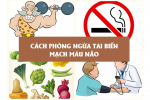 Cách phòng ngừa tai biến mạch máu não phù hợp với mọi đối tượng - XEM NGAY!