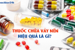 Thuốc chữa vảy nến hiệu quả là gì? XEM NGAY