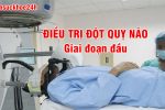 Ghi nhớ 2 giai đoạn chính trong điều trị đột quỵ não và cách cải thiện nhờ sản phẩm thiên nhiên