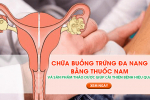 Chữa buồng trứng đa nang bằng thuốc nam và sản phẩm thảo dược giúp cải thiện bệnh hiệu quả