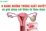 U nang buồng trứng xuất huyết và cách phòng ngừa hiệu quả từ thảo dược