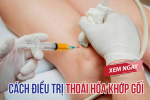 Mách bạn 4 cách điều trị thoái hóa khớp gối, bỏ qua là phí! Xem ngay!