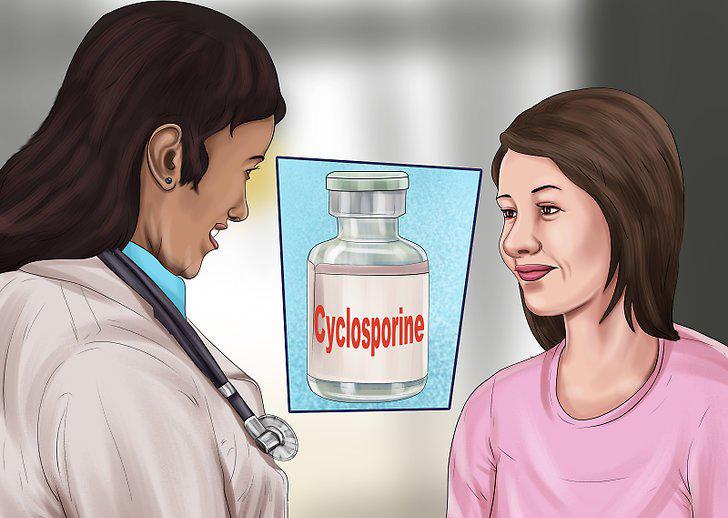 Cyclosporine là thuốc điều trị vảy nến toàn thân thường được sử dụng