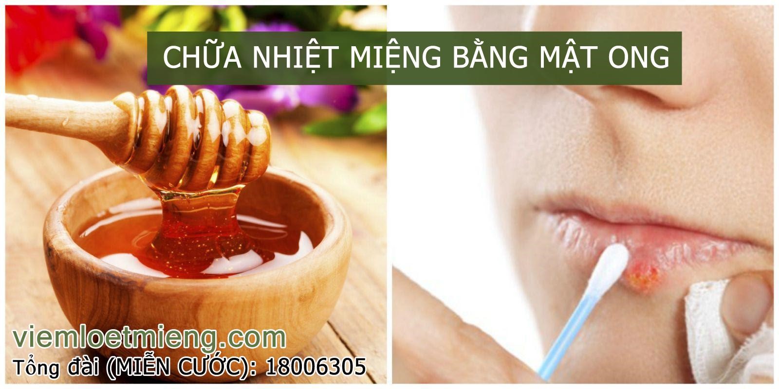 Thoa trực tiếp mật ong lên vết loét miệng