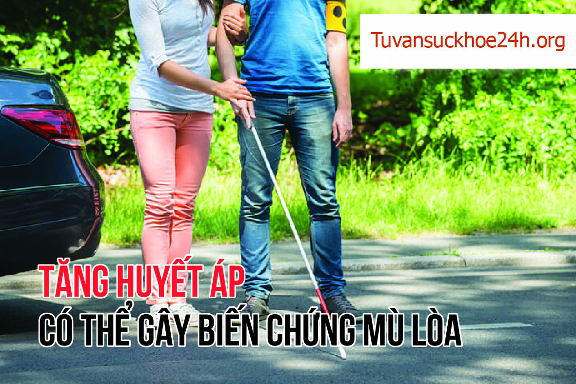  Tổn thương ở mắt do tăng huyết áp phân chia làm nhiều cấp độ