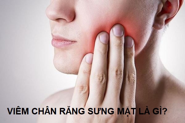   Tình trạng viêm chân răng sưng mặt